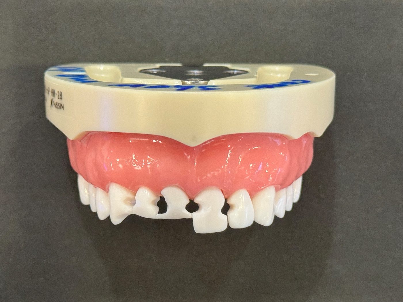 BioClear Model Before